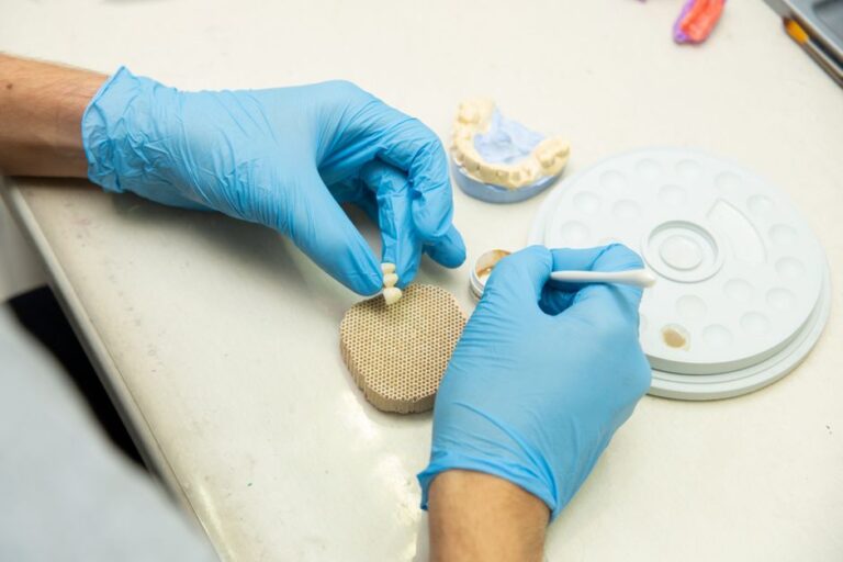 implantes dentales precio